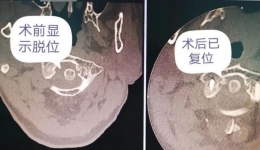 【大医精诚】疫情当前，他们做了这个手术...