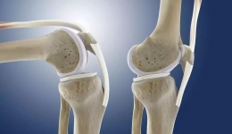 膝关节酸痛肿胀？膝关节日常保健话你知！（一）