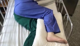 中风后患者的康复治疗----概述篇