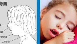 儿童常见错合畸形的早期矫治