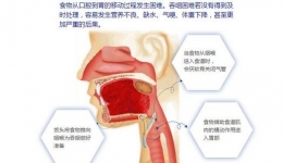 你今日吃佐未？