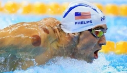 火罐印又紫又黑，究竟代表什么？解读中医拔罐（上）  开平市中心医院  2018-05-01