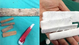 我院中医骨伤科--“广东省中医骨伤科特色专科”