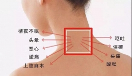 “吃”掉颈椎病