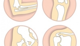 养护骨关节 当心别“踩雷”