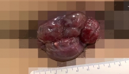 【肛肠疾病不再困扰】中西医结合肛肠亚专科诊疗中心就在开平市中心医院