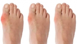 【切勿错过】2023年世界420高尿酸日暨慢病全程管理多学科联合义诊活动