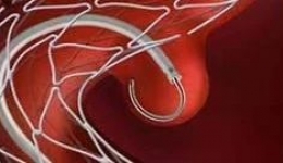 如何拆解脑内的“不定时炸弹”