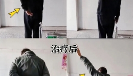 无痛松解肩关节，重获肩部自由