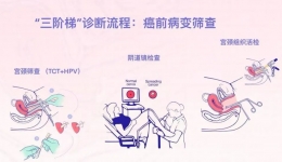 【健康科普】带您了解宫颈癌