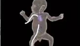 开平市中心医院新生儿科技术革新，为脆弱生命点亮希望之光