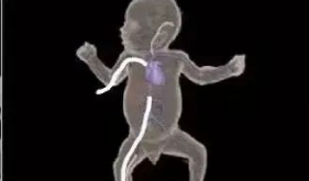 开平市中心医院新生儿科技术革新，为脆弱生命点亮希望之光