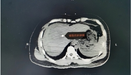 合作共建初显效，危重患者得救治